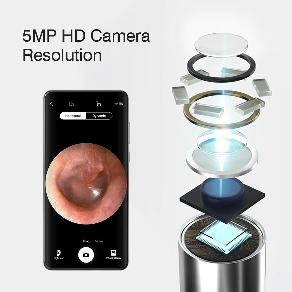 KERUI Smart Visual Ear Sticks Otoscope 5MP Endoscope Camera Wax Removal Tool Earpick Mini WIFI Camera Health Care Ear Cleaner