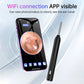 KERUI Smart Ear Wax Removal Ear Cleaner With Ear Cleaning Tool 5MP HD Camera Light Ear Wax Removal Kit Endoscope Otoscope