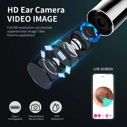 Smart Visual Ear Cleaner 1296P Ear Sticks Otoscope USB C Charging Endoscope Wax Removal Tool Earpick MIni Camera Health Care Set
