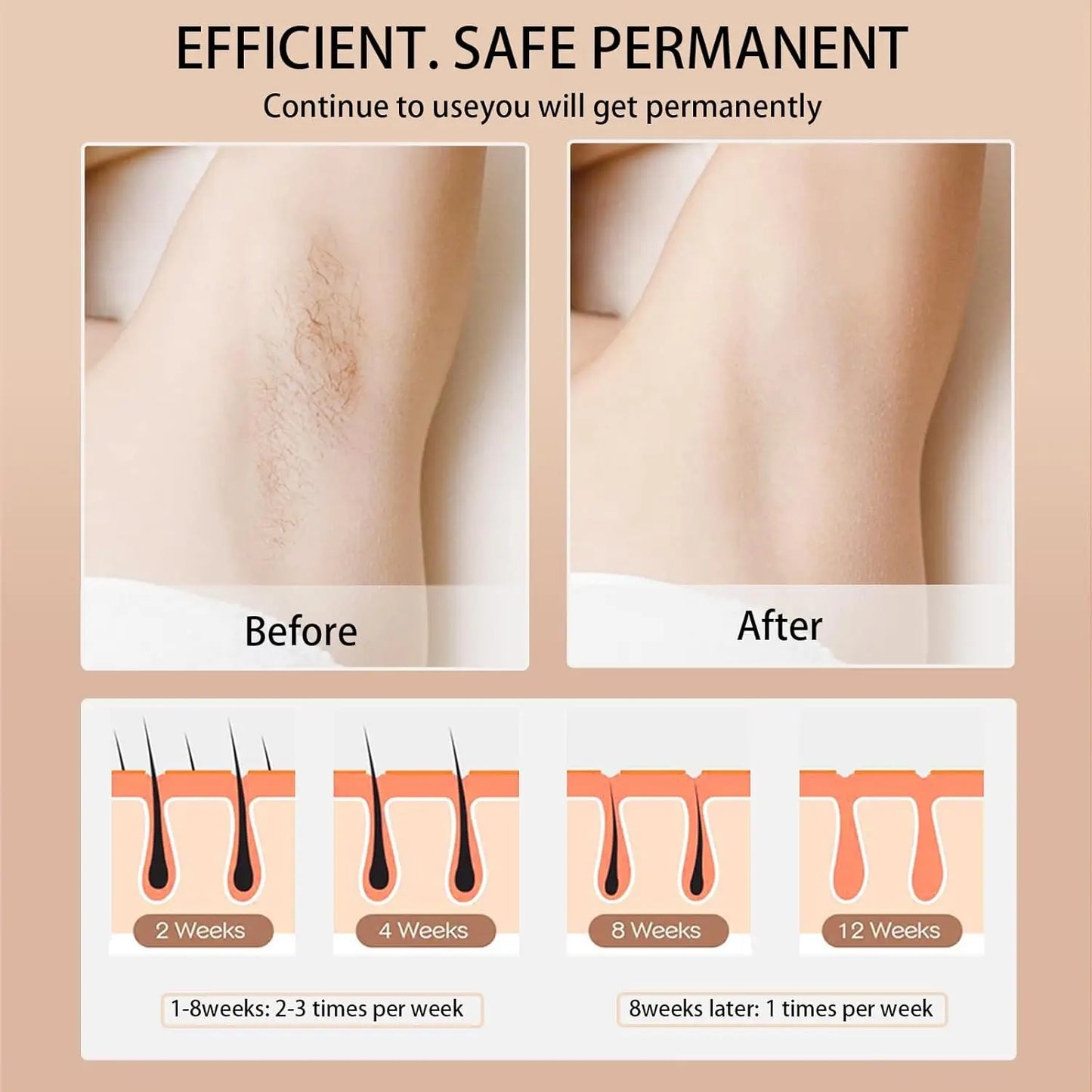 IPL Hair Removal Device 990000 Flashes for Women Painless Permanent Laser Epilator for Body Bikini and Facial Hair Home Use