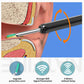 Smart Visual Ear Cleaner 1296P Ear Sticks Otoscope USB C Charging Endoscope Wax Removal Tool Earpick MIni Camera Health Care Set