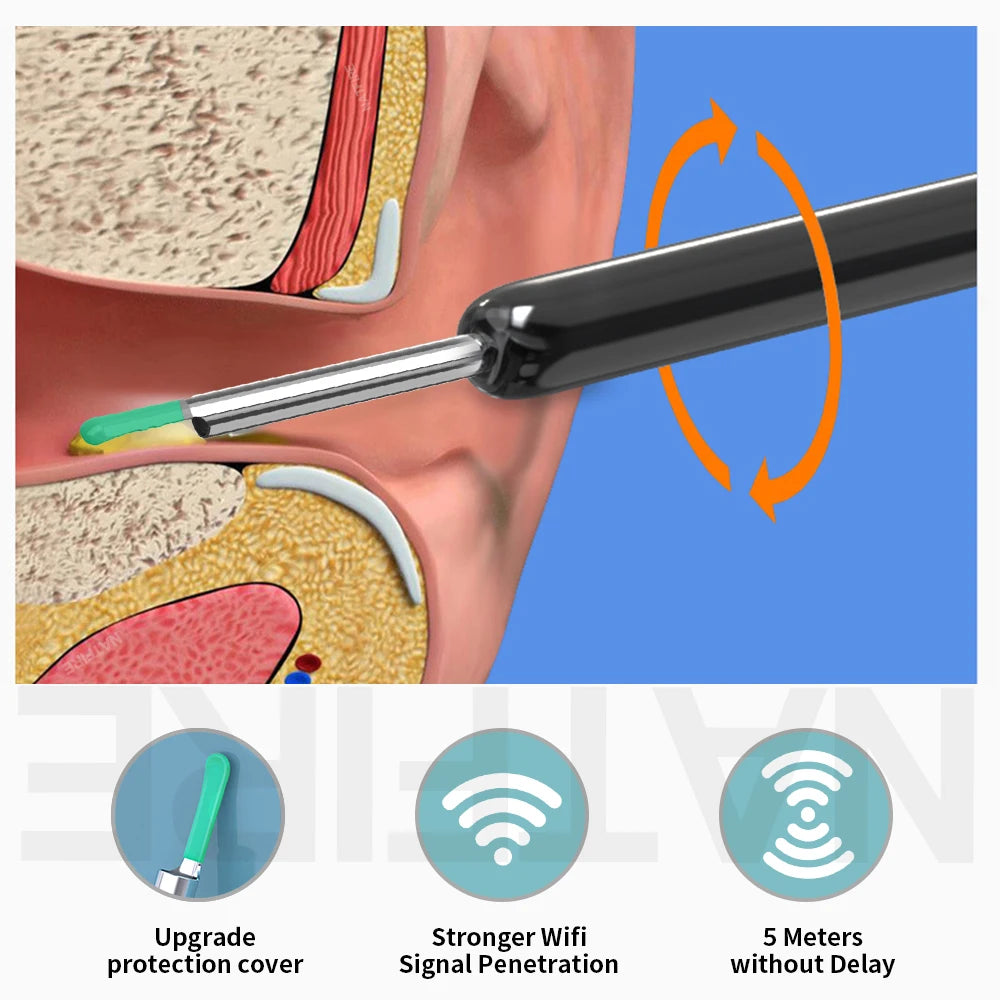 Smart Visual Ear Cleaner 1296P Ear Sticks Otoscope USB C Charging Endoscope Wax Removal Tool Earpick MIni Camera Health Care Set
