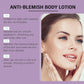 Berry Scented Blemish Lotion Care Facial Moisturizer Reduce Breakouts & Tighten Skin Non-Comedogenic Hydrator Clear Glowing